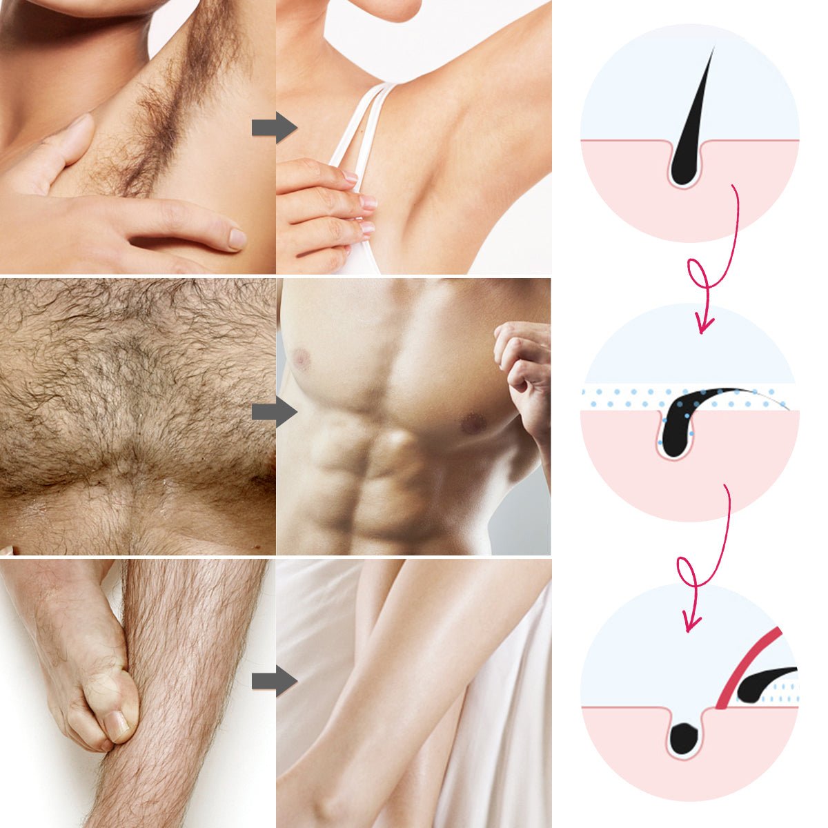 Depilador Spray Depilatorio Dermazone - ALaVueltaShop