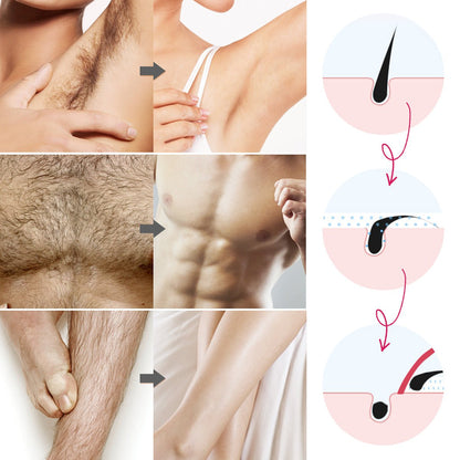 Depilador Spray Depilatorio Dermazone - ALaVueltaShop